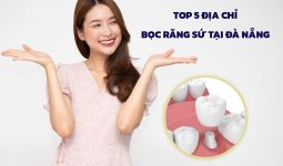 boc-rang-su-da-nang