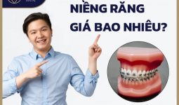 nieng-rang-gia-bao-nhieu-tien
