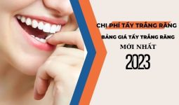 chi-phi-tay-trang-rang
